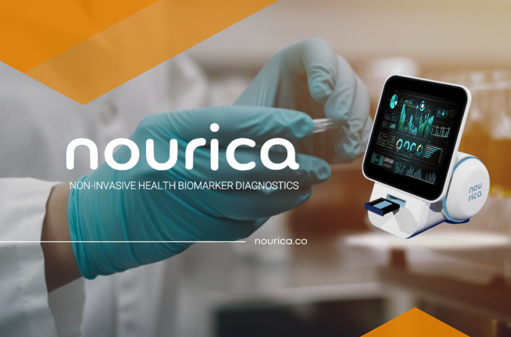 Nourica – nowoczesny sposób wykrycia chorób cywilizacyjnych